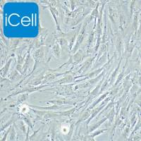 KGN、KGN细胞、人卵巢颗粒细胞瘤细胞/STR鉴定/镜像绮点(Cellverse)