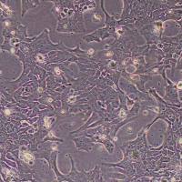 UPCI:SCC090人舌头鳞癌_UPCI:SCC090细胞细胞(STR鉴定报告)