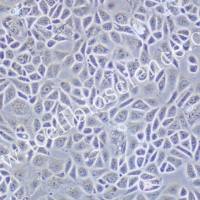 CAL-51、CAL-51细胞、CAL51细胞、CAL51人乳腺癌细胞/种属鉴定/镜像绮点(Cellverse)