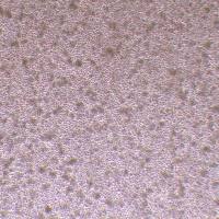 Z-138人套细胞淋巴瘤细胞_Z-138细胞(STR鉴定报告)