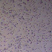 JHH-2人肝癌细胞_JHH-2细胞(STR鉴定报告)