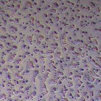 NCI-H69AR人肺癌细胞_NCI-H69AR细胞(STR鉴定)