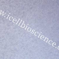 OCI-LY10、OCI-LY10细胞、OCILY10细胞、OCILY10、人弥漫大B淋巴瘤