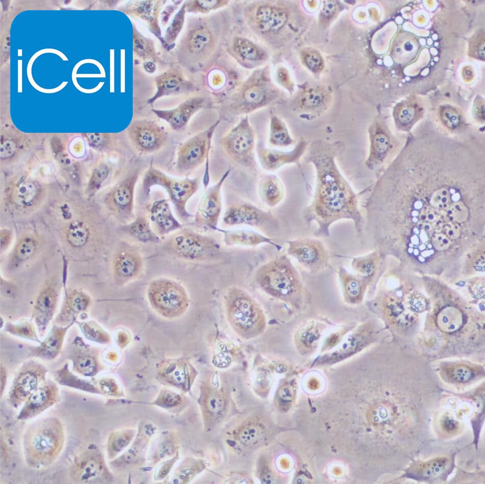 ME-180、ME-180细胞、ME180细胞、ME180、人子宫颈表皮癌细胞/STR鉴定