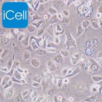 ME-180、ME-180细胞、ME180细胞、ME180、人子宫颈表皮癌细胞/STR鉴定