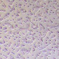 HCC70人乳腺导管癌细胞_HCC70细胞(STR鉴定报告)