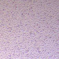 NTERA-2人恶性多发性畸胎瘤细胞_NTERA-2细胞(STR鉴定报告)