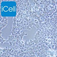 NCCIT/NCCIT细胞/人畸胎癌细胞/STR鉴定/镜像绮点(Cellverse)