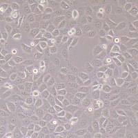 BPH-1人前列腺增生_BPH-1细胞细胞(STR鉴定报告)