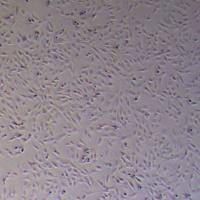 HDF-SV40T人皮肤成纤维细胞永生化