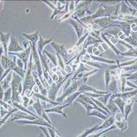 Malme-3M、Malme-3M细胞、Malme3M细胞、Malme3M、人