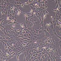 4T1-GFP-puro小鼠乳腺癌细胞-GFP标记-puro抗性