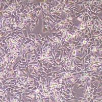 B16-OVA小鼠黑色素瘤细胞-OVA转染(种属鉴定)