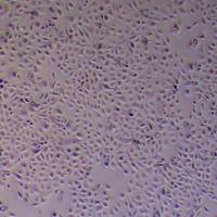 KLN205小鼠肺癌鳞癌细胞_KLN205细胞