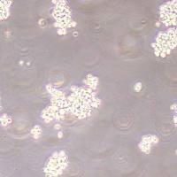 NCI-H660-NLUC-puro人神经内分泌前列腺癌细胞-NLUC标记-puro抗性