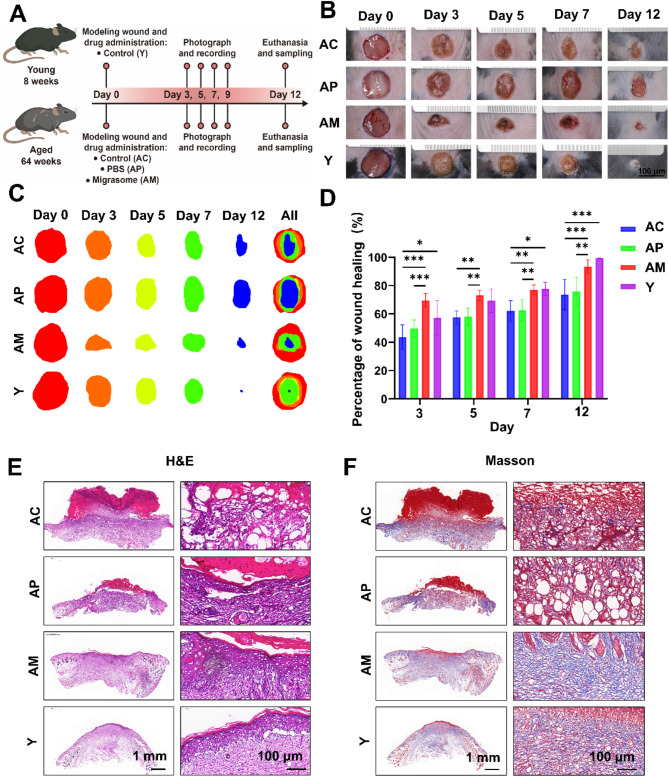 迁移体研究 迁移体研究