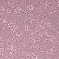 MS1小鼠胰岛内皮细胞_MS1细胞(种属鉴定)