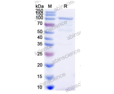 abinscience重组人腺病毒5/HAdV-5 L3/CP-H/Protein II蛋白低价购