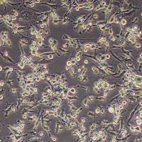 MDA-MB-436-FLUC-puro人乳腺癌细胞-FLUC标记-puro抗性