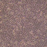 BIU-87-FLUC-puro人膀胱癌细胞-FLUC标记-puro抗性