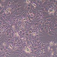 Huh7-FLUC-puro人肝癌细胞-FLUC标记-puro抗性