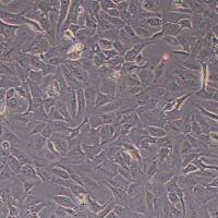 RBE-FLUC-puro人肝胆管癌细胞-FLUC标记-puro抗性