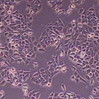 CAL-27-FLUC-puro人舌鳞癌细胞-FLUC标记-puro抗性