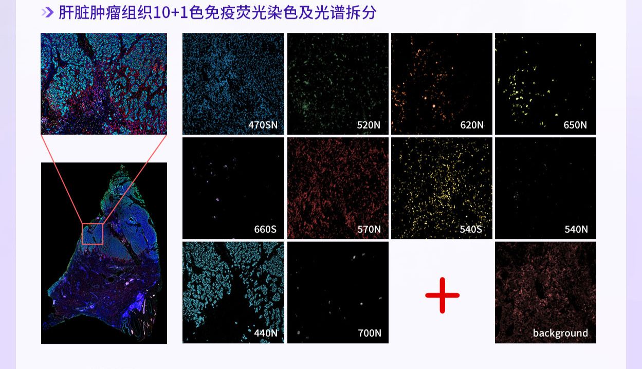 【IF25.5】Absin助力新生儿坏死性小肠结肠炎的治疗新靶点：肠道FXR与铁死亡