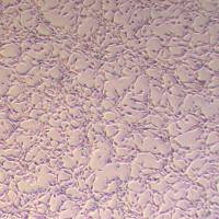 MS-5小鼠骨髓基质细胞_MS-5细胞