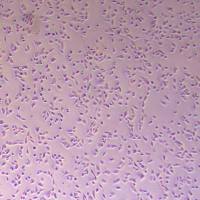 B16F10-NLUC-puro小鼠皮肤黑色素瘤细胞-NLUC标记-puro抗性