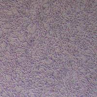 小鼠肺动脉平滑肌细胞永生化(种属鉴定)