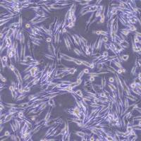 E0771-OVA小鼠乳腺癌细胞-OVA转染(种属鉴定)