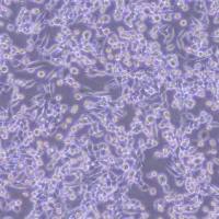 LLC-NLUC-puro小鼠Lewis肺癌细胞-NLUC标记-puro抗性