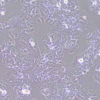 HUH7.5.1-NTCP人肝癌细胞(NTCP稳转)