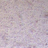 HPAC-NLUC-puro人胰腺腺泡上皮癌-NLUC标记-puro抗性