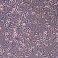 SKOV3-GFP-FLUC-puro人卵巢癌细胞(GFP/FLUC标记)