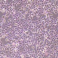 PC3-FLUC-puro人前列腺癌细胞 (FLUC标记)