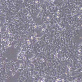 4T1-OVA小鼠乳腺癌细胞-OVA转染(种属鉴定)