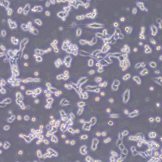 LLC-OVA小鼠Lewis肺癌细胞-OVA转染(种属鉴定)