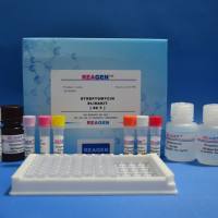 小鼠糖原合成酶激酶3β(GSK-3β)ELISA试剂盒