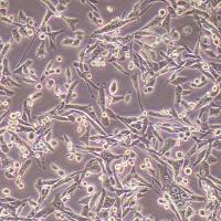 RENCA-FLUC-puro小鼠肾癌细胞-FLUC标记-puro抗性