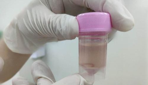 病理染色实验—组织固定注意事项