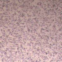 C666-1-GFP-puro人鼻咽癌细胞 (GFP标记)