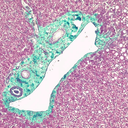 Ethos Biosciences-Gomori三色染色，助力科研高效推进