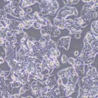 HEPG2-NTCP-puro人肝癌细胞(NTCP稳转)