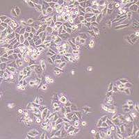 calu-6-NLUC-bsd人退行性癌细胞-NLUC标记-bsd抗性