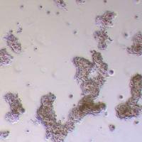 LAPC-4-FLUC-puro人前列腺癌细胞 (FLUC标记)