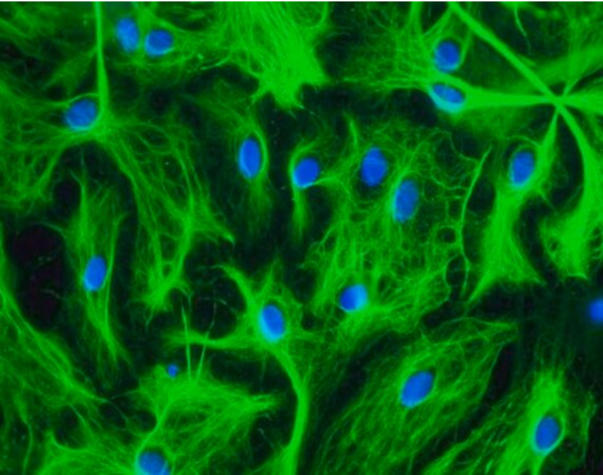 Sigma货号AB5541抗胶质纤维酸性蛋白抗体136116