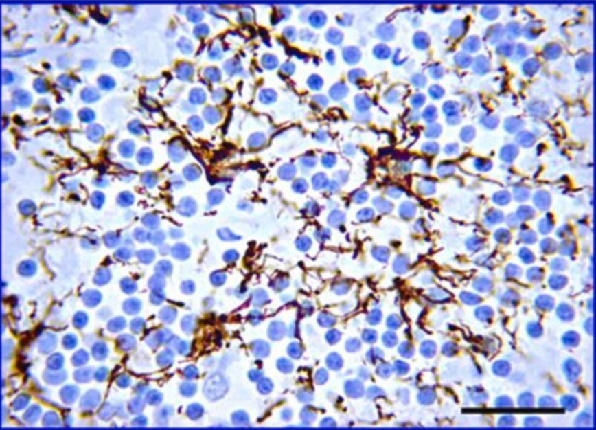 Sigma货号AB5541抗胶质纤维酸性蛋白抗体136116