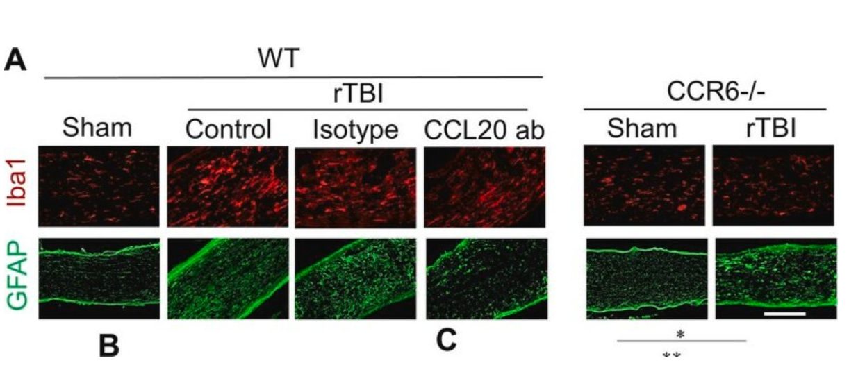 Sigma货号AB5541抗胶质纤维酸性蛋白抗体136116